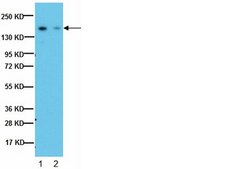 Anti-IGF-IR Antibody, &#946;-subunit, clone 1-2 clone 1-2, from mouse, purified by affinity chromatography