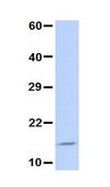 Anti-UBE2D3 antibody produced in rabbit affinity isolated antibody