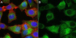 Anti-TMEM206 Antibody, clone 2H13 ZooMAb&#174; Rabbit Monoclonal recombinant, expressed in HEK 293 cells