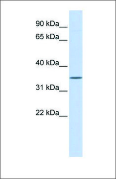 Anti-WNT1 antibody produced in rabbit affinity isolated antibody