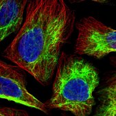 Anti-PGM2 antibody produced in rabbit Prestige Antibodies&#174; Powered by Atlas Antibodies, affinity isolated antibody, buffered aqueous glycerol solution