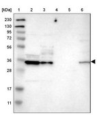 Anti-CBR3 antibody produced in rabbit Prestige Antibodies&#174; Powered by Atlas Antibodies, affinity isolated antibody, buffered aqueous glycerol solution