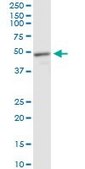 Monoclonal Anti-MECP2 antibody produced in mouse clone 4B6, purified immunoglobulin, buffered aqueous solution