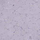 Anti-RSPH6A antibody produced in rabbit Prestige Antibodies&#174; Powered by Atlas Antibodies, affinity isolated antibody, buffered aqueous glycerol solution