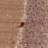 Anti-XPR1 antibody produced in rabbit Prestige Antibodies&#174; Powered by Atlas Antibodies, affinity isolated antibody, buffered aqueous glycerol solution