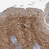 Anti-ENDOU antibody produced in rabbit Prestige Antibodies&#174; Powered by Atlas Antibodies, affinity isolated antibody, buffered aqueous glycerol solution