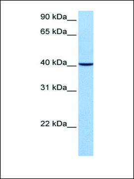 Anti-AGBL5 (AB1) antibody produced in rabbit affinity isolated antibody