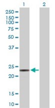 Anti-PEMT antibody produced in rabbit purified immunoglobulin, buffered aqueous solution