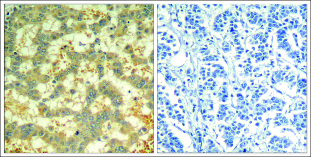 Anti-phospho-SYK (pTyr323) antibody produced in rabbit affinity isolated antibody