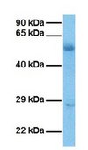 Anti-LPCAT1 antibody produced in rabbit affinity isolated antibody