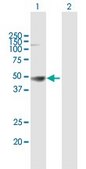 Anti-HLA-A antibody produced in mouse purified immunoglobulin, buffered aqueous solution