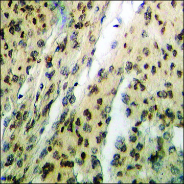 Anti-phospho-Chk1 (pSer317) antibody produced in rabbit affinity isolated antibody