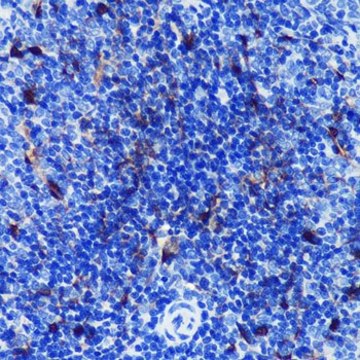 Anti-S100B antibody produced in rabbit