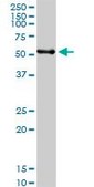 Anti-PDIA3 antibody produced in rabbit purified immunoglobulin, buffered aqueous solution