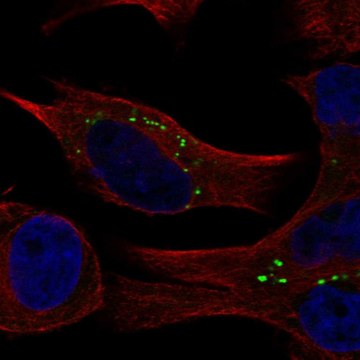 Anti-Commd2 Antibody Produced In Rabbit Prestige Antibodies&#174; Powered by Atlas Antibodies, affinity isolated antibody, buffered aqueous glycerol solution