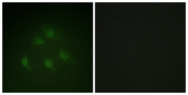 Anti-SMAD1 antibody produced in rabbit affinity isolated antibody