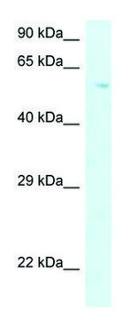 Anti-P4HA2 (C-terminal) antibody produced in rabbit affinity isolated antibody