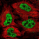 Anti-SF3B1 antibody produced in rabbit Prestige Antibodies&#174; Powered by Atlas Antibodies, affinity isolated antibody, buffered aqueous glycerol solution