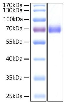 Recombinant 2019-nCoV Spike S2 ECD Protein with His tag