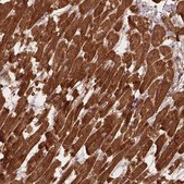 Anti-XPR1 antibody produced in rabbit Prestige Antibodies&#174; Powered by Atlas Antibodies, affinity isolated antibody, buffered aqueous glycerol solution