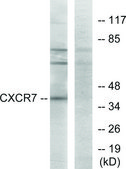 Anti-CXCR7 antibody produced in rabbit affinity isolated antibody