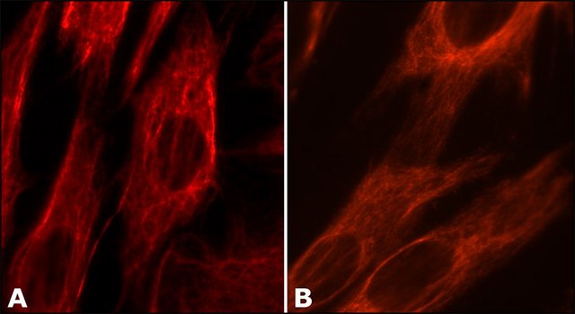 Anti-Vimentin antibody, Mouse monoclonal clone VIM-13.2, purified from hybridoma cell culture