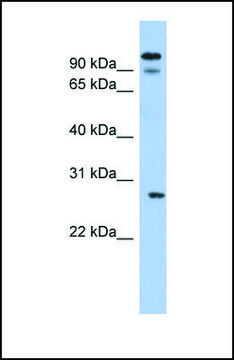 Anti-VDAC3, (N-terminal) antibody produced in rabbit affinity isolated antibody