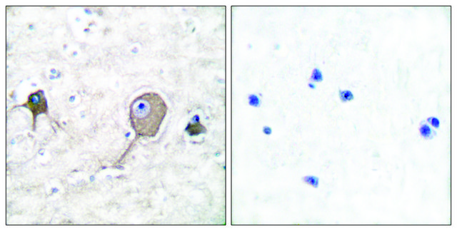 Anti-NSE antibody produced in rabbit affinity isolated antibody