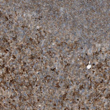 Anti-ABTB1 antibody produced in rabbit Prestige Antibodies&#174; Powered by Atlas Antibodies, affinity isolated antibody, buffered aqueous glycerol solution