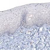 Anti-IGF2BP3 antibody produced in rabbit Prestige Antibodies&#174; Powered by Atlas Antibodies, affinity isolated antibody, buffered aqueous glycerol solution