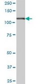 Anti-HK1 antibody produced in mouse purified immunoglobulin, buffered aqueous solution