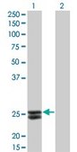 Monoclonal Anti-PRL, (C-terminal) antibody produced in mouse clone 1E1, purified immunoglobulin, buffered aqueous solution