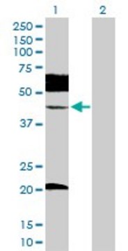 Anti-UBE2Q2 antibody produced in rabbit purified immunoglobulin, buffered aqueous solution