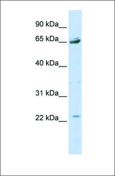 Anti-P2RX2 (ab4) antibody produced in rabbit affinity isolated antibody