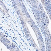 Anti- Bax antibody produced in rabbit