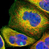 Anti-USP2 antibody produced in rabbit Ab1, Prestige Antibodies&#174; Powered by Atlas Antibodies, affinity isolated antibody, buffered aqueous glycerol solution