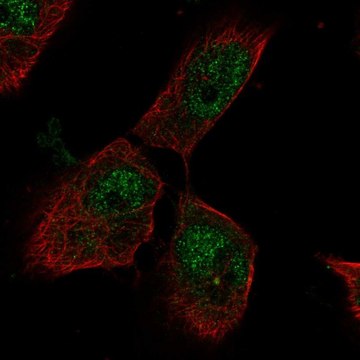 Anti-PTTG1IP antibody produced in rabbit Prestige Antibodies&#174; Powered by Atlas Antibodies, affinity isolated antibody