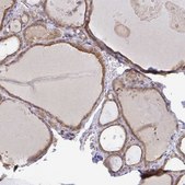 Anti-DERL2 antibody produced in rabbit Prestige Antibodies&#174; Powered by Atlas Antibodies, affinity isolated antibody, buffered aqueous glycerol solution