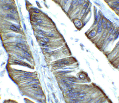 Anti-TET2 antibody produced in rabbit affinity isolated antibody