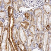 Anti-KRT18 antibody produced in rabbit Prestige Antibodies&#174; Powered by Atlas Antibodies, affinity isolated antibody, buffered aqueous glycerol solution