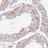 Anti-PARP2 antibody produced in rabbit Prestige Antibodies&#174; Powered by Atlas Antibodies, affinity isolated antibody, buffered aqueous glycerol solution