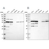 Anti-CCT8 antibody produced in rabbit Prestige Antibodies&#174; Powered by Atlas Antibodies, affinity isolated antibody, buffered aqueous glycerol solution
