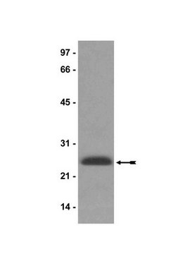 Anti-HP1&#947; Antibody, clone 42s2 clone 42s2, Upstate&#174;, from mouse