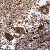 Anti-LRPPRC antibody produced in rabbit Prestige Antibodies&#174; Powered by Atlas Antibodies, affinity isolated antibody, buffered aqueous glycerol solution