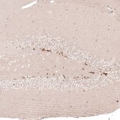 Monoclonal Anti-SOX4 antibody produced in mouse Prestige Antibodies&#174; Powered by Atlas Antibodies, clone CL5665, purified immunoglobulin, buffered aqueous glycerol solution
