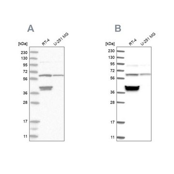 Anti-TCP1 antibody produced in rabbit Prestige Antibodies&#174; Powered by Atlas Antibodies, affinity isolated antibody, buffered aqueous glycerol solution, ab1
