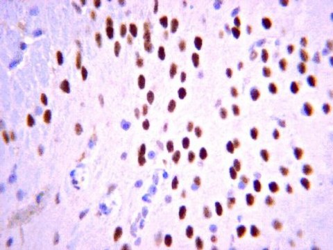 Anti-Tbr1 Antibody from chicken, purified by affinity chromatography