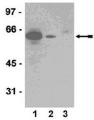 Anti-Akt1/PKB&#945; Antibody, clone AW24 | 04-796 clone AW24, from rabbit