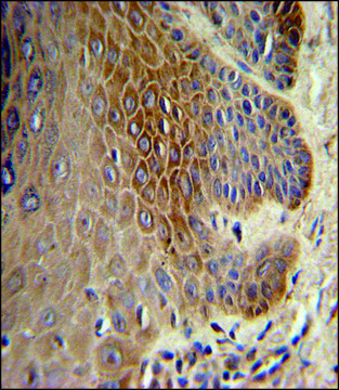 ANTI-COL17A1 (CENTER) antibody produced in rabbit IgG fraction of antiserum, buffered aqueous solution