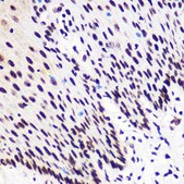 Anti-Phospho-Smad2-S465/467 + Smad3-S423/425 antibody produced in rabbit